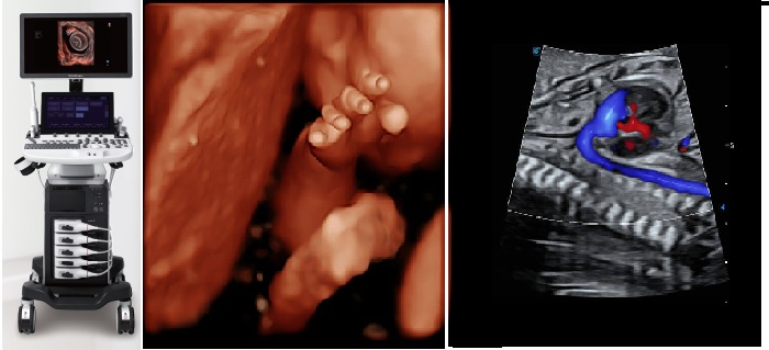 SonoART Medikal Slider